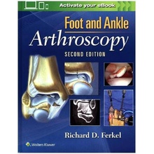 Foot & Ankle Arthroscopy