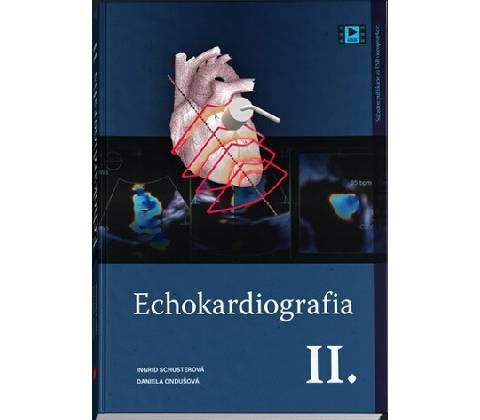 Echokardiografia II.