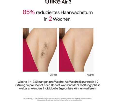 Ulike Air3