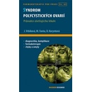 Syndrom polycystických ovarií - David Cibula, Luboslav Stárka, Jana Vrbíková