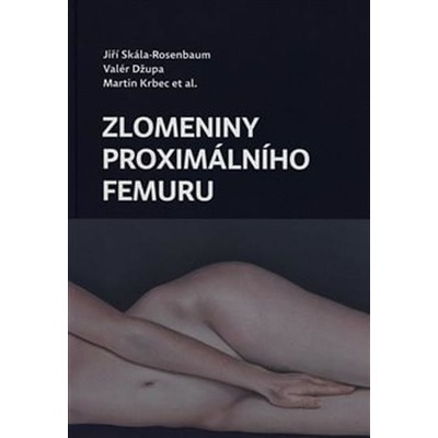 Zlomeniny proximálního femuru - Kolektiv