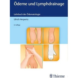 Ödeme und Lymphdrainage | Ulrich Herpertz (ISBN: 9783132435803)