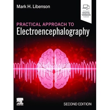 Practical Approach to Electroencephalography