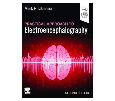 Practical Approach to Electroencephalography