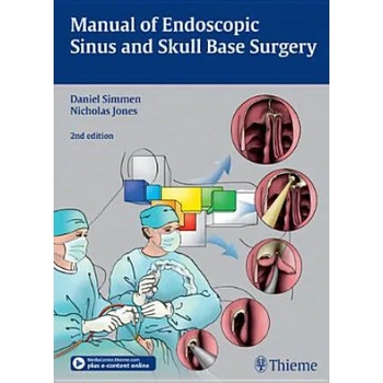 Image 1 of Manual of Endoscopic Sinus and Skull Base Surgery
