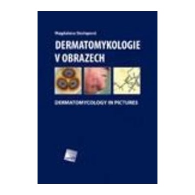 Dermatomykologie v obrazech