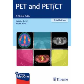 Image 1 of PET and PET/CT | Eugene C. Lin, Abass Alavi