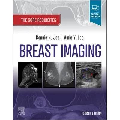 Breast Imaging | Bonnie N. Joe, Amie Y. Lee