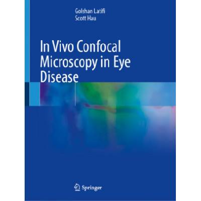 In Vivo Confocal Microscopy in Eye Disease | Golshan Latifi, Scott Hau