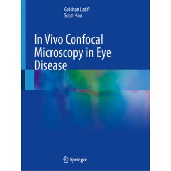 In Vivo Confocal Microscopy in Eye Disease | Golshan Latifi, Scott Hau