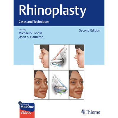 Rhinoplasty - Jason S. Hamilton, Michael S. Godin