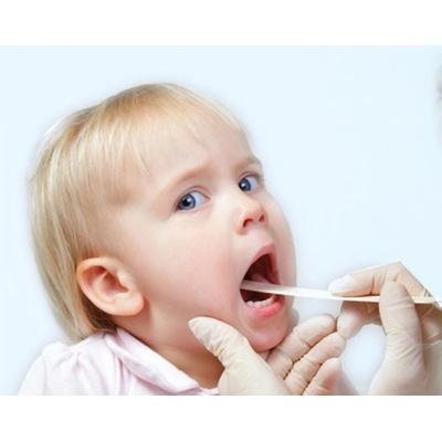 Novamed No-Step Strep domáci test na streptokokovú infekciu