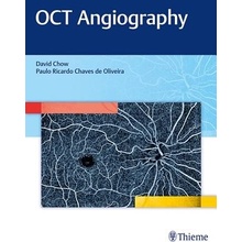 Oct Angiography Chow David