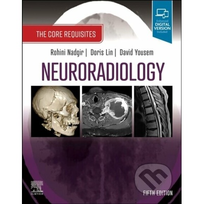 Neuroradiology