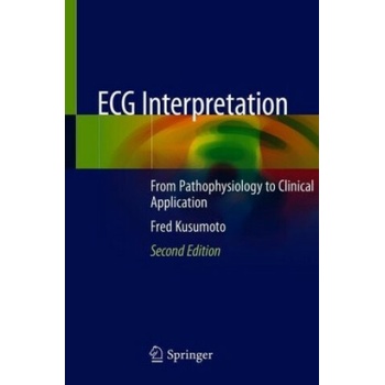 ECG Interpretation