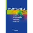 ECG Interpretation