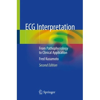 ECG Interpretation