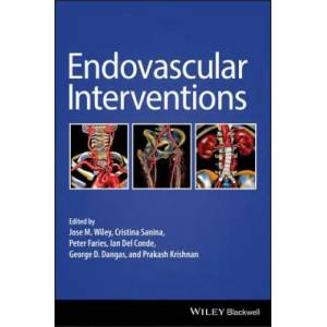 Endovascular Interventions | JOSE WILEY (ISBN: 9781119283492)