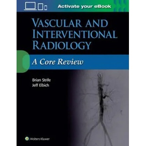 Vascular and Interventional Radiology: A Core Review | Strife, Brian, MD, Jeffrey Elbich (ISBN: 9781496384393)