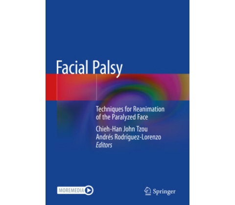 Facial Palsy