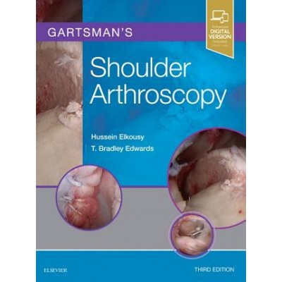 Gartsmans Shoulder Arthroscopy