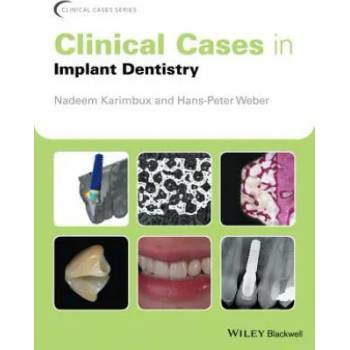 Image 1 of Clinical Cases in Implant Dentistry | Nadeem Karimbux
