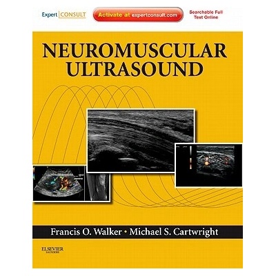 Neuromuscular Ultrasound