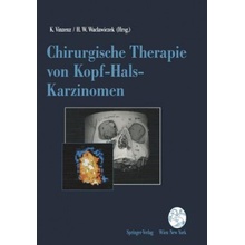 Chirurgische Therapie Von Kopf-Hals-Karzinomen