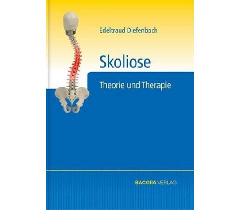 Skoliose