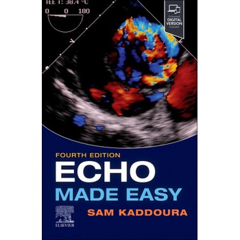 Echo Made Easy - Sam Kaddoura