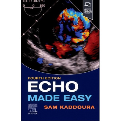 Echo Made Easy - Sam Kaddoura