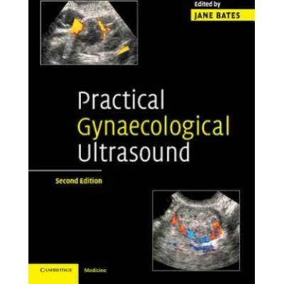 Practical Gynaecological Ultrasound | Jane Bates