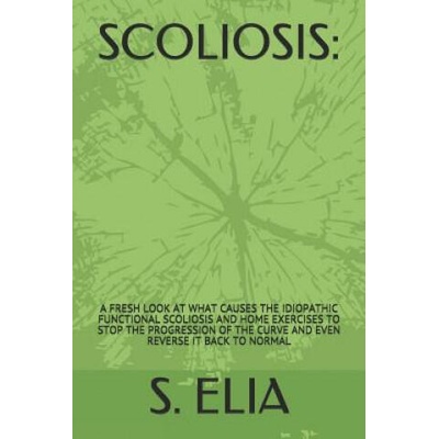 Scoliosis: : A Fresh Look at What Causes the Idiopathic Functional Scoliosis and Home Exercises to Stop the Progression of the Cu | S Elia