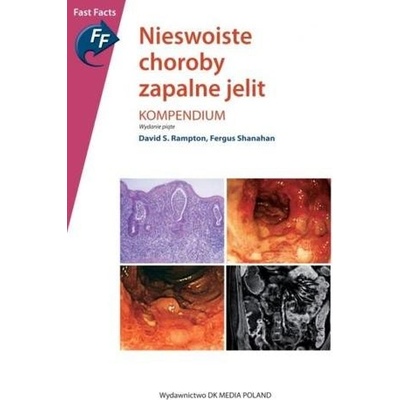 NIESWOISTE CHOROBY ZAPALNE JELIT KOMPEND IUM BR.DK MEDIA 9788394924324