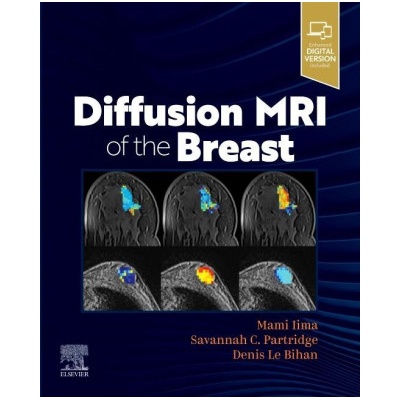 Diffusion MRI of the Breast | Mami Iima, Savannah Partridge, Denis Le Bihan