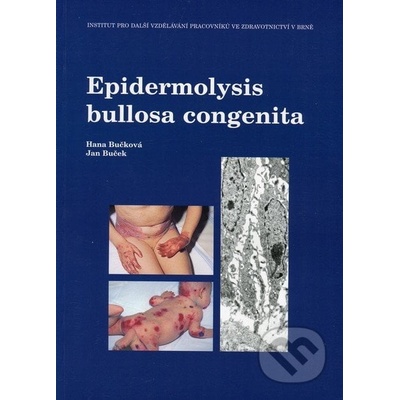 Epidermolysis bullosa congenita Hana Bučková, Jan Buček
