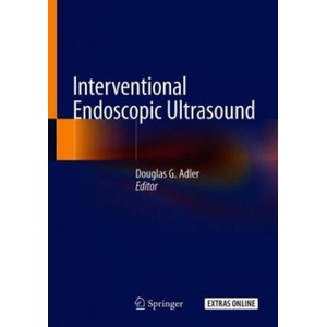 Interventional Endoscopic Ultrasound | Douglas G. Adler (ISBN: 9783319973753)