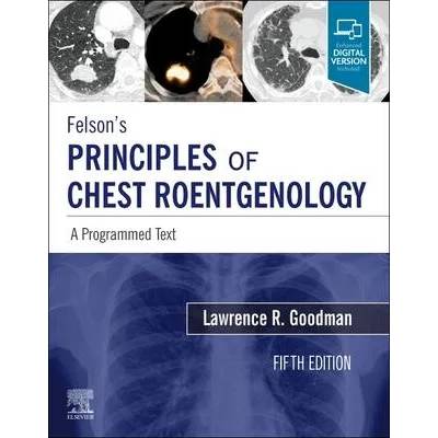 Felson's Principles of Chest Roentgenology, A Programmed Text | Lawrence R Goodman