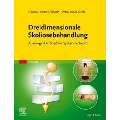 Dreidimensionale Skoliosebehandlung