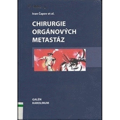 Chirurgie orgánových metastáz - Ivan Čapov