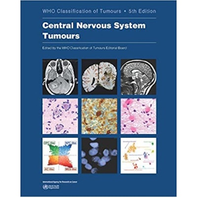 WHO Classification of Tumours: Central Nervous System Tumours - World Health Organization