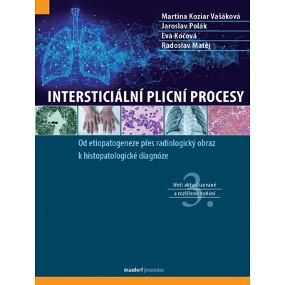 Intersticiální plicní procesy