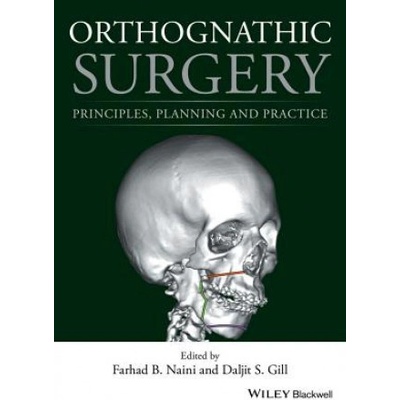 Orthognathic Surgery - Principles, Planning and Practice Naini Farhad B.Pevná vazba