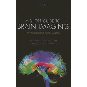 Short Guide to Brain Imaging | Passingham, Richard E. (Emeritus Fellow, Wadham College, University of Oxford, UK), Rowe, James B. (Professor of Cognitive Neurology at Cambridge University, Wellcome Trust Senior Research Fellow, and (ISBN: 9780198709138)