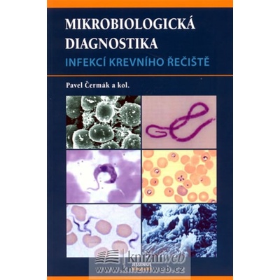 Mikrobiologická diagnostika infekcí krevního řečiště - Pavel Čermák