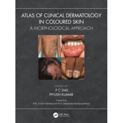 Atlas of Clinical Dermatology in Coloured Skin Taylor & Francis Ltd