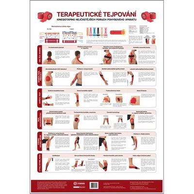 Vydavateľstvo Poznání Anatomický plagát - Terapeutické tejpovanie 48 x 70 cm | CS
