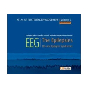 Atlas of Electroencephalography -- Volume 2 | Dr Philippe Gelisse, Dr Arielle Crespel, Michelle Bureau, Pierre Genton (ISBN: 9782742015917)