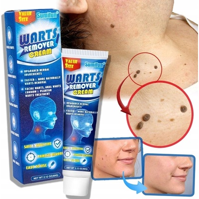 WART REMOVAL CREAM Krém pro okamžité odstranění bradavic 60 g