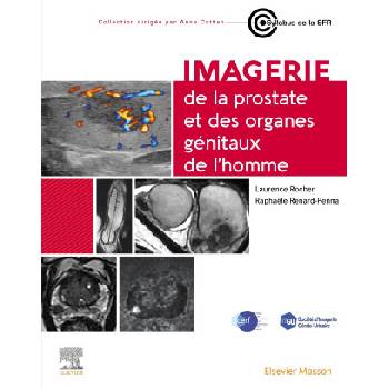 Imagerie de la prostate et des organes génitaux de l'homme
